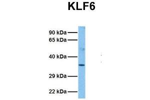Host:  Rabbit  Target Name:  KLF6  Sample Tissue:  Human Fetal Liver  Antibody Dilution:  1.
