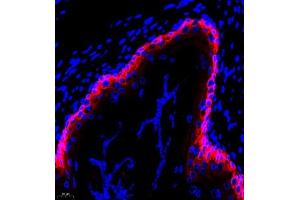 Immunofluorescent analysis of paraffin embedded rat stomcah using CK6 (ABIN7074423) at dilution of 1: 2000 (Keratin 6 Antikörper)