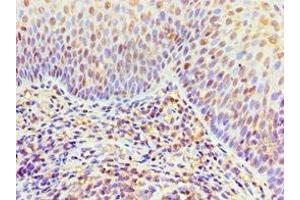 Immunohistochemistry of paraffin-embedded human tonsil tissue using ABIN7156454 at dilution of 1:100 (ITGA9 Antikörper  (AA 30-250))