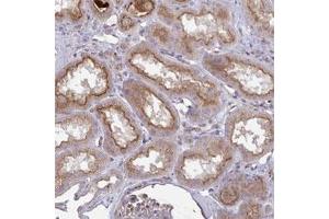 Immunohistochemical staining of human kidney shows moderate cytoplasmic and membranous positivity in cells in tubules.