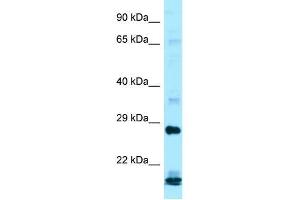 Western Blotting (WB) image for anti-Interferon, alpha 16 (IFNA16) (C-Term) antibody (ABIN2788554) (IFNA16 Antikörper  (C-Term))