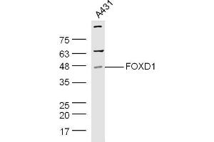 Human A431 cell lysates probed with Rabbit Anti-Pan FOXD Polyclonal Antibody, Unconjugated  at 1:500 for 90 min at 37˚C. (FOXD (AA 131-230) Antikörper)