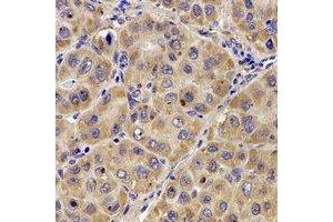 Immunohistochemical analysis of Complement C7 staining in human liver formalin fixed paraffin embedded tissue section.