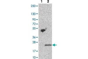 Western blot analysis of Lane 1: Negative control (vector only transfected HEK293T lysate). (TMEM69 Antikörper)
