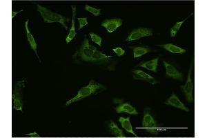 Immunofluorescence of monoclonal antibody to SP1 on HeLa cell. (SP1 Antikörper  (AA 522-618))