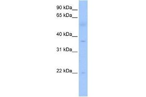 RG9MTD3 antibody used at 1 ug/ml to detect target protein. (RG9MTD3 Antikörper)