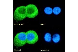 (ABIN571024) Immunofluorescence analysis of paraformaldehyde fixed A431 cells, permeabilized with 0.