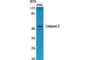 Western Blot (WB) analysis of specific cells using Caspase-2 Polyclonal Antibody. (Caspase 2 Antikörper  (Ser197))