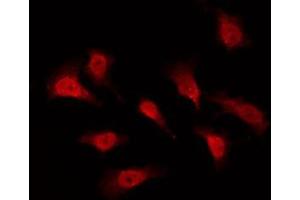 ABIN6276016 staining Hela by IF/ICC. (GPR153 Antikörper  (Internal Region))