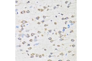 Immunohistochemistry of paraffin-embedded rat brain using COPB2 antibody (ABIN5974232) at dilution of 1/100 (40x lens). (COPB2 Antikörper)
