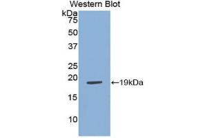 Western blot analysis of the recombinant protein. (Adrenomedullin Antikörper  (AA 31-187))
