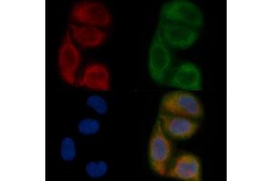 ALG6 Mouse Monoclonal Antibody staining Hela cells by IF/ICC. (ALG6 Antikörper)