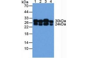 Figure. (COMT Antikörper  (AA 52-271))