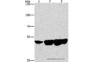 Western blot analysis of Hela, hepG2 and 231 cell, using CTBP2 Polyclonal Antibody at dilution of 1:400 (CTBP2 Antikörper)