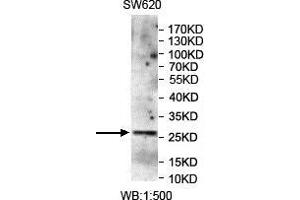 WB analysis of SW620 lysates, using CMTM4 antibody. (CMTM4 Antikörper)