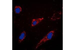 Immunofluorescent analysis of EPAC1 staining in A549 cells. (RAPGEF3 Antikörper  (C-Term))