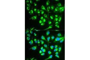 Immunofluorescence analysis of MCF-7 cells using SLC22A5 antibody.