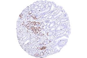 Stomach with a strong membranous CLDN3 staining of a small subset of epithelial cells in the neck and in glandular pits. (Rekombinanter Claudin 3 Antikörper  (Intracellular))