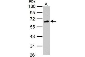 WB Image Sample (30 ug of whole cell lysate) A: U87-MG 10% SDS PAGE antibody diluted at 1:1000 (CAMKK2 Antikörper  (N-Term))