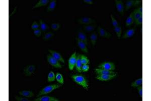 Immunofluorescent analysis of HepG2 cells using ABIN7147586 at dilution of 1:100 and Alexa Fluor 488-congugated AffiniPure Goat Anti-Rabbit IgG(H+L) (CLIC2 Antikörper  (AA 53-247))