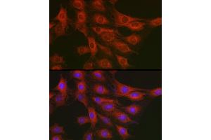 Immunofluorescence analysis of C6 cells using GART Rabbit pAb (ABIN1679954, ABIN3018225, ABIN3018226 and ABIN6220407) at dilution of 1:200 (40x lens). (GART Antikörper  (AA 1-320))