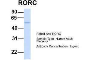 Host:  Rabbit  Target Name:  RORC  Sample Type:  Human Adult Placenta  Antibody Dilution:  1. (RORC Antikörper  (Middle Region))