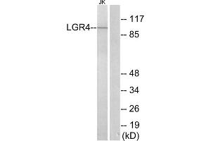 Western blot analysis of extracts from Jurkat cells, using LGR4 antibody. (LGR4 Antikörper  (Internal Region))