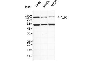Western Blotting (WB) image for anti-Programmed Cell Death 6 Interacting Protein (PDCD6IP) (C-Term) antibody (ABIN7273068) (ALIX Antikörper  (C-Term))