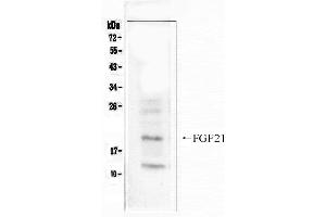 Western blot analysis of FGF21  using anti- FGF21 antibody .