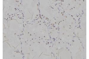 ABIN6277196 at 1/100 staining Human lung tissue by IHC-P.