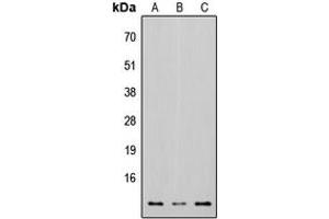 Western blot analysis of Osteocalcin expression in HEK293T (A), Raw264. (Osteocalcin Antikörper  (Center))