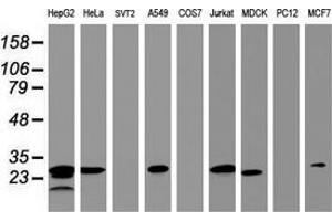 Western Blotting (WB) image for anti-Hydroxysteroid (17-Beta) Dehydrogenase 8 (HSD17B8) (AA 57-261) antibody (ABIN2715557) (HSD17B8 Antikörper  (AA 57-261))