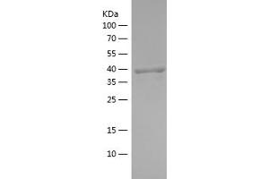 Western Blotting (WB) image for Flotillin 1 (FLOT1) (AA 107-253) protein (His-IF2DI Tag) (ABIN7122982) (Flotillin 1 Protein (FLOT1) (AA 107-253) (His-IF2DI Tag))