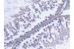 Detection of KTN1 in Rat Testis Tissue using Polyclonal Antibody to Kinectin 1 (KTN1) (KTN1 Antikörper  (AA 1162-1325))