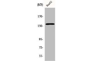 Western Blot analysis of HepG2 cells using p140Cap Polyclonal Antibody (SRCIN1 Antikörper  (Internal Region))