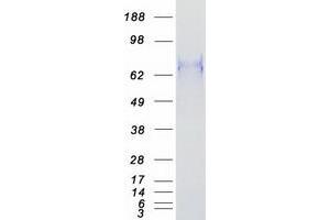 Western Blotting (WB) image for B-Cell CLL/lymphoma 6 (BCL6) (Transcript Variant 1) protein (Myc-DYKDDDDK Tag) (ABIN2715204)
