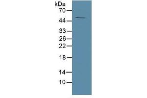 Rabbit Detection antibody from the kit in WB with Positive Control: Human tibia lysate. (MMP13 CLIA Kit)