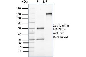 SDS-PAGE Analysis Purified Involucrin Mouse Monoclonal Antibody (SPM259). (Involucrin Antikörper)