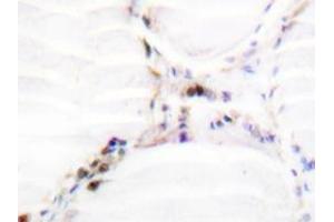 Immunohistochemistry analysis of Vitamin D3 receptor / NR1I1 antibody in paraffin-embedded human thyroid gland tissue. (Vitamin D Receptor Antikörper)