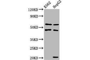 Western Blot Positive WB detected in: K562 whole cell lysate, HepG2 whole cell lysate All lanes: GATB antibody at 3. (PET112L Antikörper  (AA 301-383))
