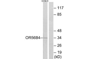 Western blot analysis of extracts from COLO cells, using OR56B4 antibody. (OR56B4 Antikörper  (C-Term))