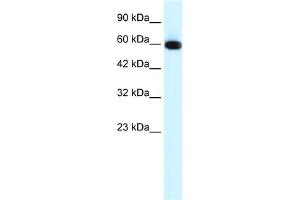 WB Suggested Anti-GLIS2 Antibody Titration:  0. (GLIS2 Antikörper  (N-Term))