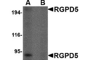 Western Blotting (WB) image for anti-RANBP2-Like and GRIP Domain Containing 5 (RGPD5) (Middle Region) antibody (ABIN1031059) (RGPD5 Antikörper  (Middle Region))