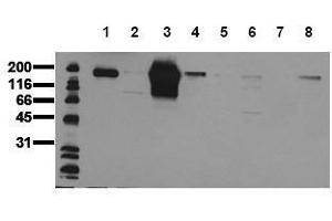 Western Blotting (WB) image for anti-Receptor tyrosine-protein kinase erbB-2 (ErbB2/Her2) (AA 860-880) antibody (ABIN126788) (ErbB2/Her2 Antikörper  (AA 860-880))