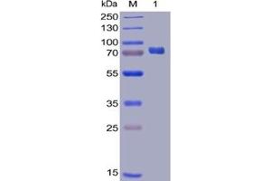 Human PD-L1 Protein, mFc-His Tag on SDS-PAGE under reducing condition. (PD-L1 Protein (mFc-His Tag))