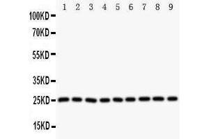 Western Blotting (WB) image for anti-Superoxide Dismutase 2, Mitochondrial (SOD2) (AA 45-62), (N-Term) antibody (ABIN3044165) (SOD2 Antikörper  (N-Term))