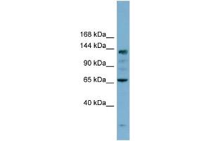 WB Suggested Anti-IARS Antibody Titration: 0. (IARS Antikörper  (N-Term))