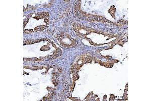 IHC analysis of COX5B using anti-COX5B antibody (ABIN7598975). (COX5B Antikörper  (AA 1-129))