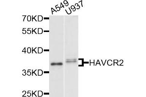 Western blot analysis of extracts of various cell lines, using HAVCR2 antibody (ABIN5971348) at 1/1000 dilution. (TIM3 Antikörper)