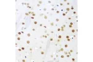 Immunohistochemistry of paraffin-embedded mouse brain using UNG antibody at dilution of 1:100 (40x lens). (UNG Antikörper)